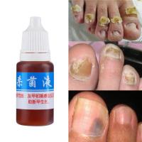 10ml Health Skin Care Nail Repair Liquid Cleanser Onychomycosis Remover