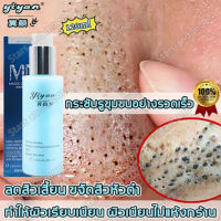 ?รูขุมขนหดตัวสาระสำคัญ?120ml ทำให้ผิวขาวขึ้น เติมเต็มความชุ่มชื้นให้ผิว เซรั่มหน้าใสเซรั่มบำรุงผิว รูขุมขนหดตัว รูขุมขนกระชับขึ้น ไวท์เทนนิ่ง เซรั่มกระชับใบหน้า กรดไฮยาลูโรนิก เซรั่มบำรุงผิวหน้า เซรั่มยกกระชับ เซรั่มหน้าใสไว เอสเซนส์บำรุง Firming serum