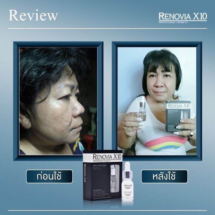 ตรงปก-จบปัญหาผิวหน้า-ของแท้-renovia-x10-professional-cosmetic-ฺั-by-18-อีกครั้ง