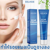 EELHOE Scar Cream ครีมทาแผลเป็น แท้ 100% ลบรอยแผลเป็น ช่วยให้แผลเป็นจางหายอย่างมีประสิทธิภาพ ลดรอยแผลเป็น ครีมแผลเป็น เจลซ่อมแซม เจลรอยแผลเป็น 30g