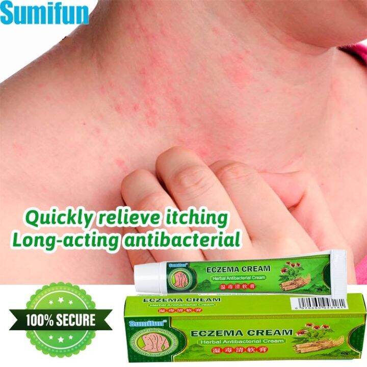 20g Eczema Cream Psoriasis Cream Eczema Ointment Eczema Lotion Relieve