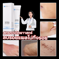 car removal gel แผลจากน้ำร้อนลวก ครีมแก้ขาลาย 30g แผลไฟไหม้ เจลบำรุงแผลเป็นใหม่ ครีมลบรอยแผลดำ