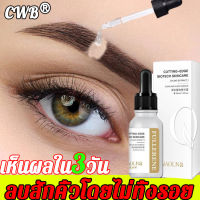 【ไม่เจ็บ】QaoLNa น้ำยาลบรอยสัก 30ml ลบรอยสักเร็วใน 7 วัน สูตรอ่อนโยน ไม่ระคายเคืองผิว ไม่มีรอยแผลเป็น (ครีมลบรอยสัก,น้ำลบรอยสักคิ้ว,ยาลบรอยสัก, ที่ลบรอยสัก,ลบรอยสัก)Tattoo removal serum