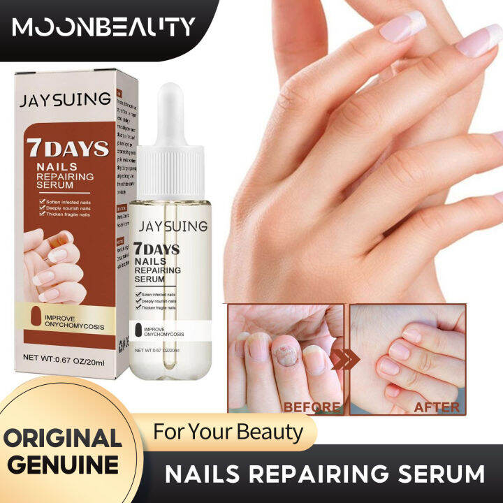 Jaysuing Repairing Nail Essence Softening Toenails Infections Removal