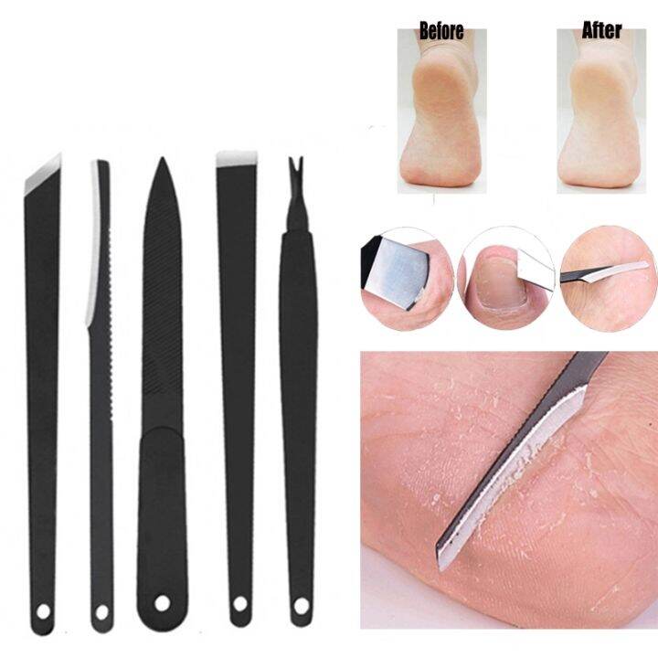 5Pcs/Set Foot Dead Skin Foot Crack Corn Calluses Remover Toe Pedicure