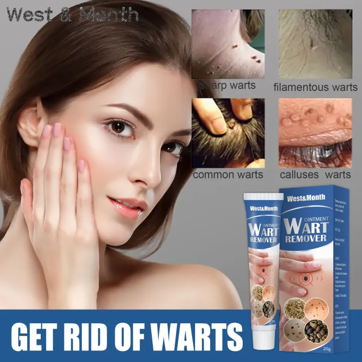 Wart Removal Ointment Fast Remove Remover Original Ointment Against Mole And Genital Wart Foot 2800