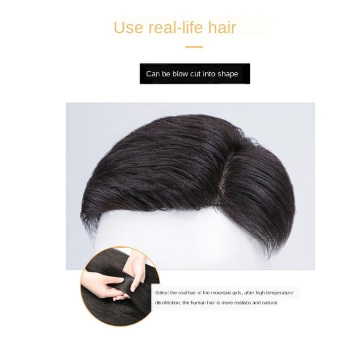 wig-mens-korean-style-handsome-mens-wig-head-reissue-piece-forehead-reissue-bald-hairpiece-real-hair-wig-set-dbv