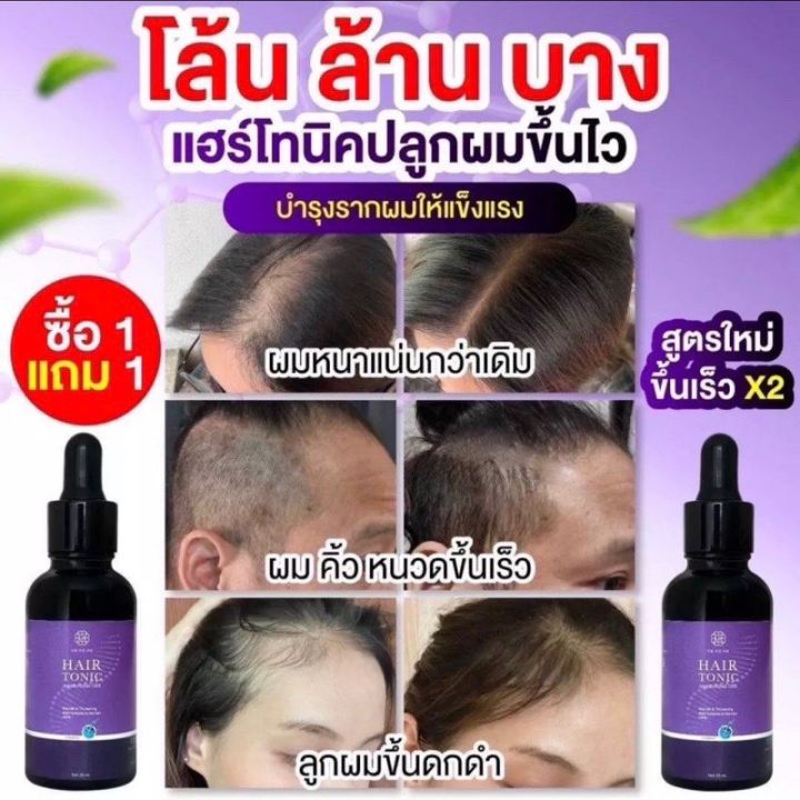 ส่งฟรี-chaba-ชบาโทนิค-ปลูกผม-ป้องกันผมร่วง