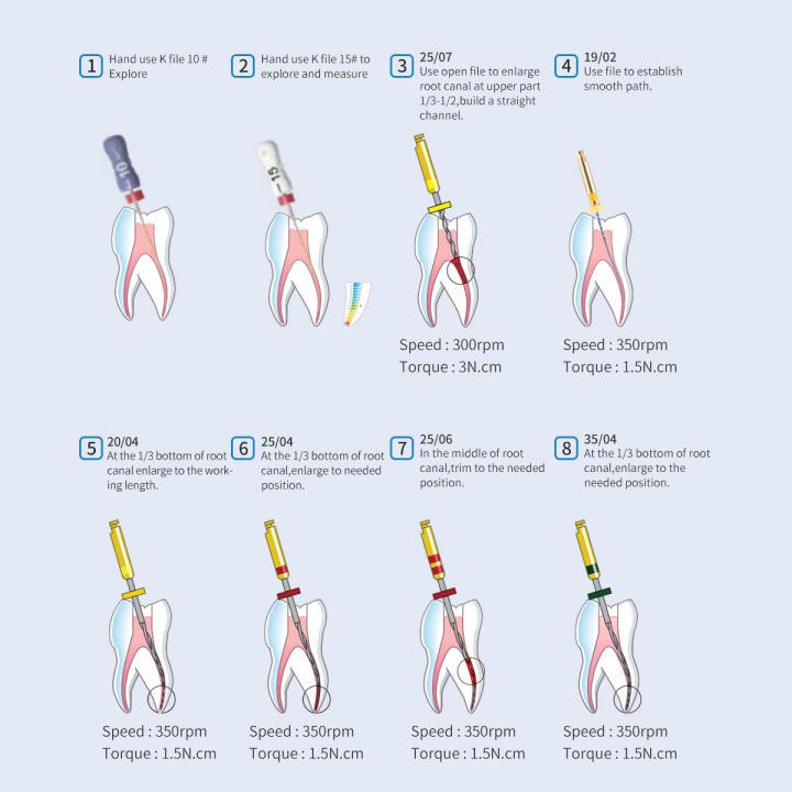 6ชิ้นกล่องทันตกรรม25mm-endo-ไฟล์เครื่องยนต์ใช้รากคลองเครื่องมือ-niti-ไฟล์โลหะผสม