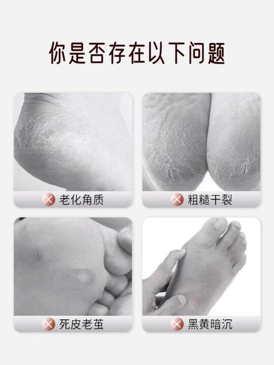 time-give-vitamin-e-silicone-moisturizing-leg-warmers-foot-membrane-to-protect-the-heel-gel-exfoliator-prevent-weather-shack