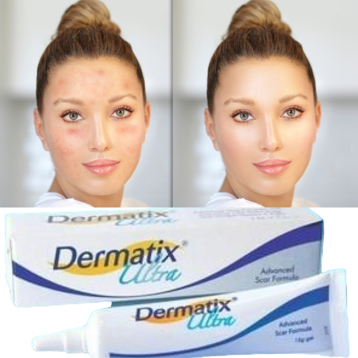 Dermatix Dermatix Ultra Gel Gel Penghilang Bekas Luka Dan Penghilang Jerawat Obat Salep Bekas