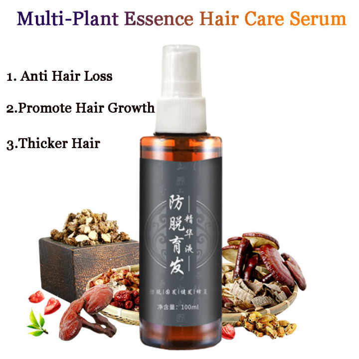In stock] Anti-hair loss artifact rapid growth hair care spray 100ml,  suitable for male and female hairline, promote hair growth, prevent hair  loss, improve hair follicle nutrition, rapid growth hair care spray |