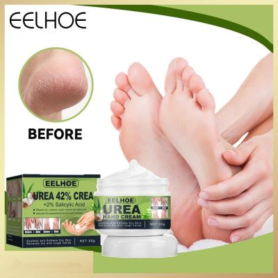 【CW】 Hand Foot Care Urea Cream Exfoliating Moisturizer Body Repair Anti drying cracking Heel Mask Removal Callus Whitening