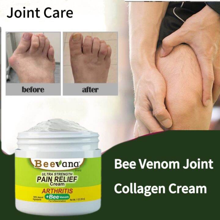 Bee Venom Joint Collagen Cream 30g Eliminates Swelling Relieves Sore ...