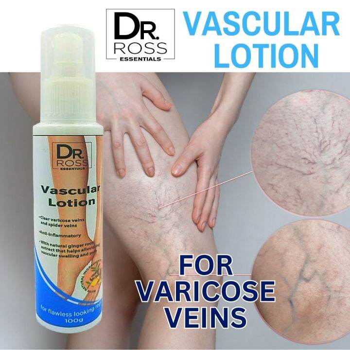 Dr. Ross PH Vascular Lotion, for Varicose Veins & Spider Veins, KEEP
