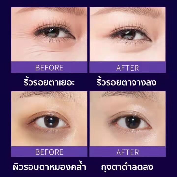 ของแท้-100-ครีมลดถุงใต้ตา-เมจิกอายครีม-ครีมถุงใต้ตา-ครีมทาถุงใต้ตา-ถุงใต้ตาบวม-ครีมทารอบดวงตา-กระชับ-ยกกระชับ-อายครีมลดใต้ตา-eye-cream