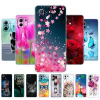 ✸◈☋ For xiaomi Mi 11 / Mi 11 Lite 5G NE 4G / Mi 11i / Mi 11 Ultra Case Back Phone Cover For Xiomi Mi11Lite Silicon Soft TPU Bumper