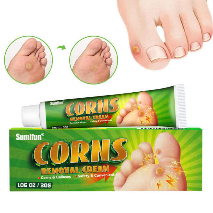 Corn Removers For Feet Corn Removers For Toe Foot CornToe CornCallus