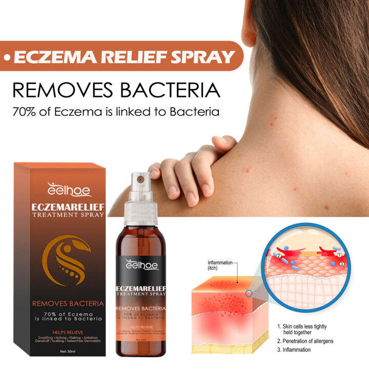 Eelhoe Eczema Relief Treatment Spray Itching Liquid Relief Spray ...