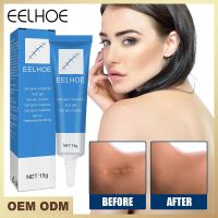 Scar Removal Cream Treatment Surgical Scar Burn Repair Cream External Cold Application Cream Skin Whitening Beauty New in stock