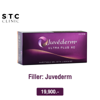 [E-voucher] ฟิลเลอร์ Juvederm