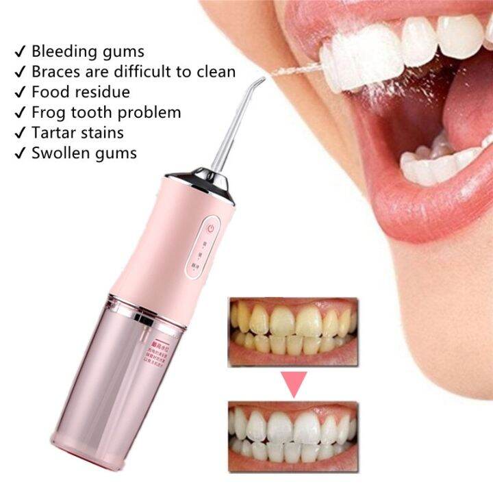 Tooth flosser Highspeed water scours teeth gaps to remove tooth stains