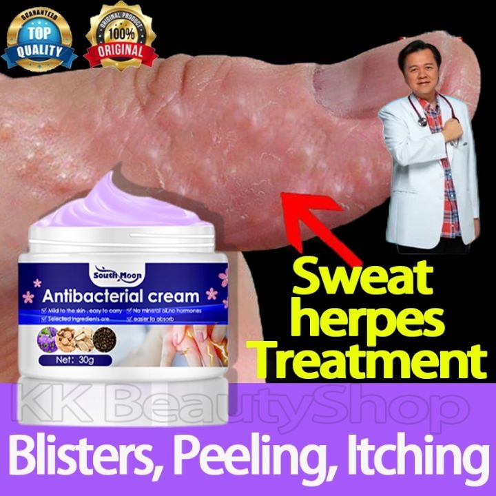 Eczema Cream Effective Anti-itch Sweat Herpes Treatment Atoderma ...