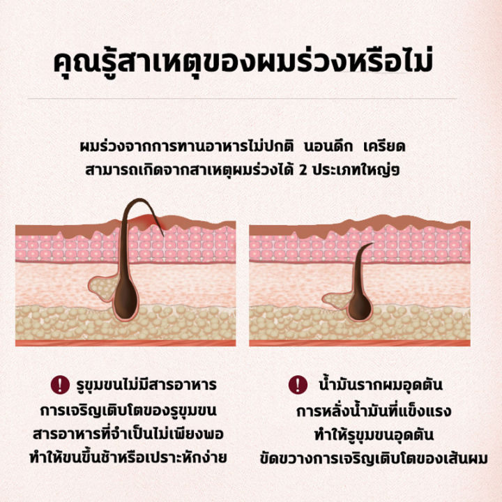 แชมพูแก้ผมร่วง-500-ml-แชมพูลดผมร่วง-เพิ่มวอลุ่ม-anti-hairloss-shampoo-2-in-1-shampoo-x-conditioner-ปริมาณ-ป้องกันผมร่วง-ครีมสระผม-แชมพูเร่งผมยาว-ยาสระผมแก้ร่วง-ยาสระผมเร่งยาว-shampoo-hair-แชมพูสระผม-ย