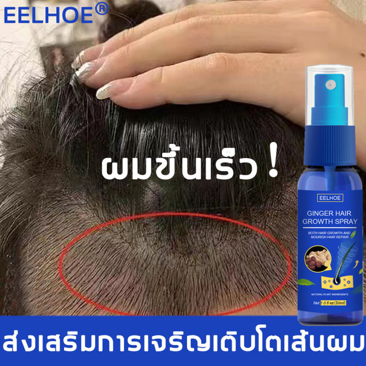 บอกลาหัวล้าน-eelhoe-สเปรย์ปลูกผม-เร่งผมขึ้นใหม่-เร่งผมยาวไว-ป้องกันผมร่วง-ป้องกันผมร่วงอย่างมืออาชีพ-แก้ปัญหาผมร่วง-ลดผมร่วง-น้ำยาใส่ผม-ยาปลูกผม-น้ำยาปลูกผม-น้ำยาเร่งผมยาว-เซรั่มปลูกผม-ปลูกผมเร่งด่วน-