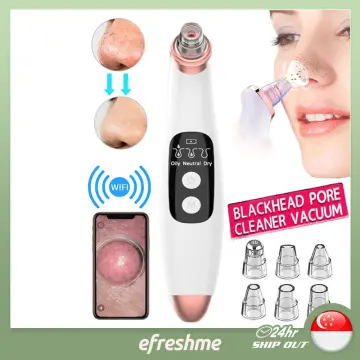 Blackheads Remover Vacuum Suction - Best Price In Singapore - Jul 2023 |  Lazada.Sg