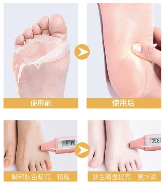 vha-foot-mask-สปาเท้า-มาร์คเท้า-มาร์คเท้าแตก-ถุงเท้าสปาเท้า-ถุงเท้าสปา-มาร์คเท้าลอ-มาร์คเท้าขาว-มาร์คเท้านุ่ม-บำรุงเท้า-เท้าแตก-35g