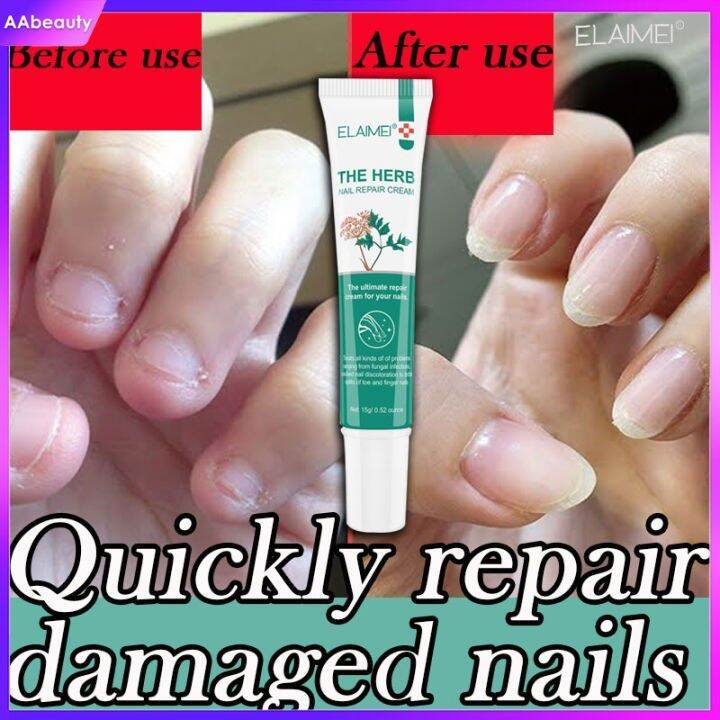 ELAIMEI 100 Effective R15g emove Onychomycosis Fungal Nail Treatment