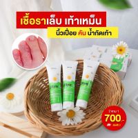 ส่งฟรี ครีมทาเชื้อรานิ้วมือ นิ้วเท้า!!! Ultra U อัลตร้ายู ครีมทาสะเก็ดเงิน กลาก เกลื้อน น้ำกัดเท้า ครีมทาแก้คัน คันในร่มผ้า รอยดำยุง