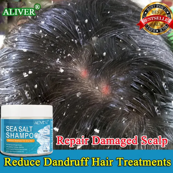 Fast and effective ALIVER Sea Salt Shampoo Deeply Clean The Scalp Reduce Dandruff Refreshing Oil Control (Anti-dandruff shampoo/Hair Treatment Shampoo/psoriasis shampoo/Sea Salt Anti Dandruff Shampoo /Removal Mites Shampoo/Anti-itch shampoo)200g ... Fast and effective ALIVER Sea Salt Shampoo Deeply Clean The Scalp Reduce Dandruff Refreshing Oil Control (Anti-dandruff shampoo/Hair Treatment Shampoo/psoriasis shampoo/Sea Salt Anti Dandruff Shampoo /Removal Mites Shampoo/Anti-itch shampoo)200g ...
