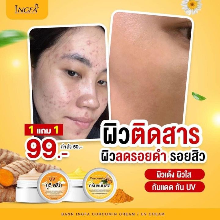 ครีมขมิ้นสด-สลๅ-ยฝ้ๅ-ครีมอิงฟ้า-ของเเท้100-พร้อมส่ง