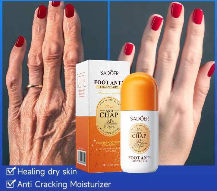 SADOER FOOT CHAPPED GEL Foot Hand Cream Tangan Kaki Krim Tumit Pecah
