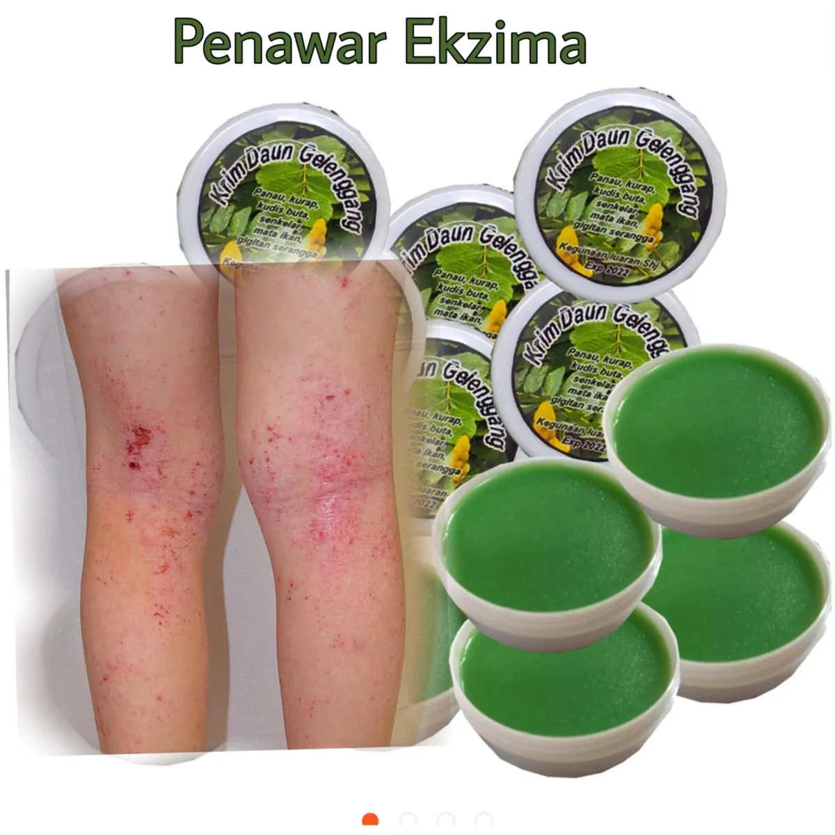 Krim Daun Gelenggang100 Asli Untuk Gatal Panau Kurap Kudis Ruam Peluh Bayi Lazada