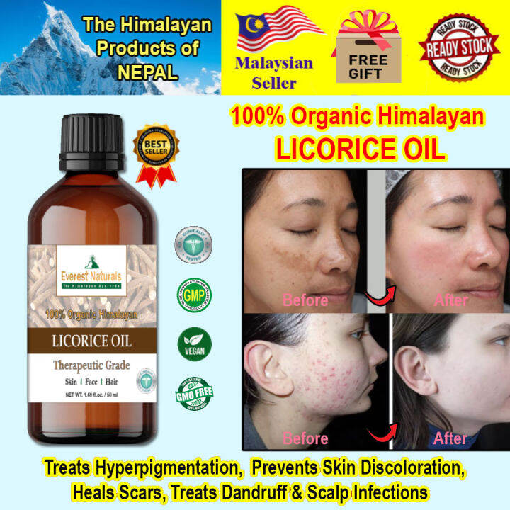 100 Organic Licorice Oil THERAPEUTIC GRADE (50ml) Lazada