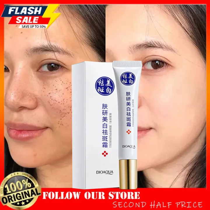 Second Half Price 🔥【cod】 Effective Freckle Removal Whitening Cream Melasma Removal Cream