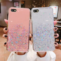 เคสโทรศัพท์สำหรับ OPPO A37 A39 A57 A59 A59S A73 A77 A79 A83หรูหรานุ่มน่ารักปลอกกันกระแทก