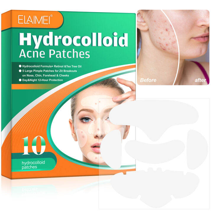 hanbi-1bag-elaimei-microneedles-anti-acne-patch-pimple-removal