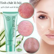 Kem dưỡng da chống mụn Aloe Vera Gel Làm mờ vết thâm Làm trắng da Dưỡng ẩm
