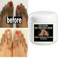 Fast Feet lightening cream , Spotless feet, Fast action , Fast results Remove Dark Skin Lightening Bleaching Body Skin Kojic AHA