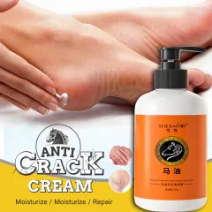 Oaktree 30g Foot Cream Horse Oil ,Best Callus Remover For Feet, Knees&  Elbows,Natural Moisturizes Nourishes Softens Dry, Rough, Cracked, Dead Skin  