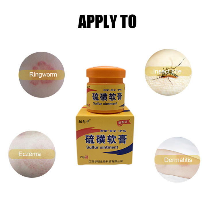 ZB 20g Sulphur Antibacterial Cream Itchy Skin Insect Bite Balm Rash ...