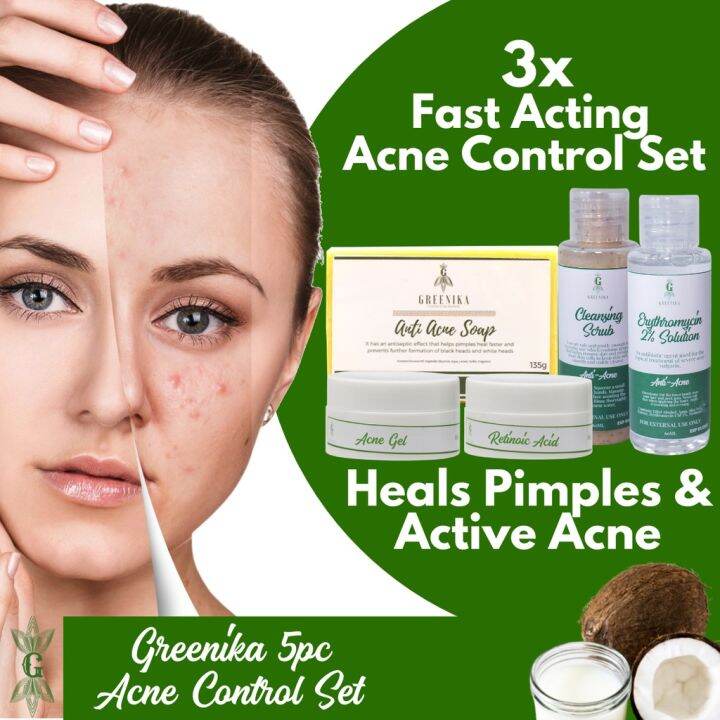 Explosive Models Acne Control Set Greenika 5pc Acne Control Set Acne