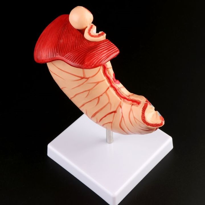 human-anatomical-anatomy-stomach-medical-model-gastric-pathology-gastritis-ulcer-medical-teaching-learning-tool