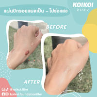 แผ่นปิดแผลเป็น บรรจุ 1 แผ่น/กล่อง KOIKOI Scar Film