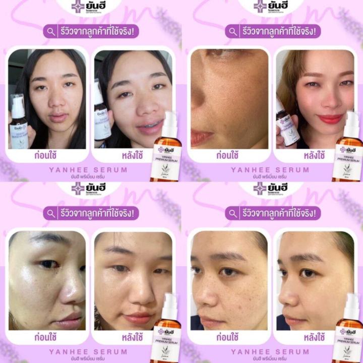 2ขวด-เซรั่มยันฮี-แท้-ยันฮี-พรีเมียม-เซรั่ม-yanhee-serum-เซรั่มแก้ฝ้า-สิว-สินค้าพร้อมส่ง