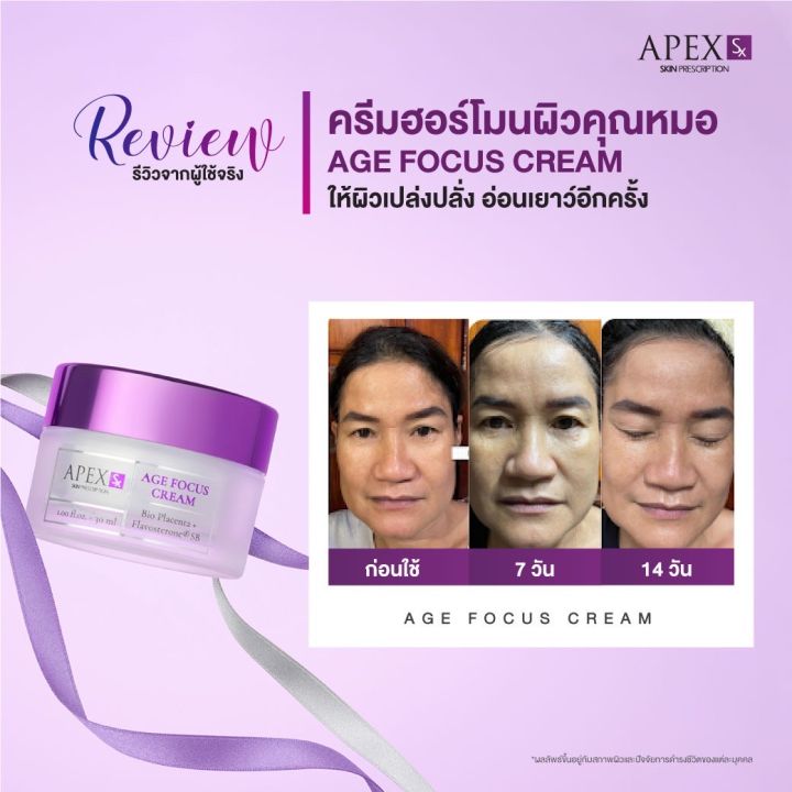 apex-sx-age-focus-cream-ครีมฮอร์โมนผิวสูตรคุณหมอเอเพ็กซ์-ผิวสดใสเปล่งปลั่ง-อ่อนเยาว์อีกครั้ง-30ml